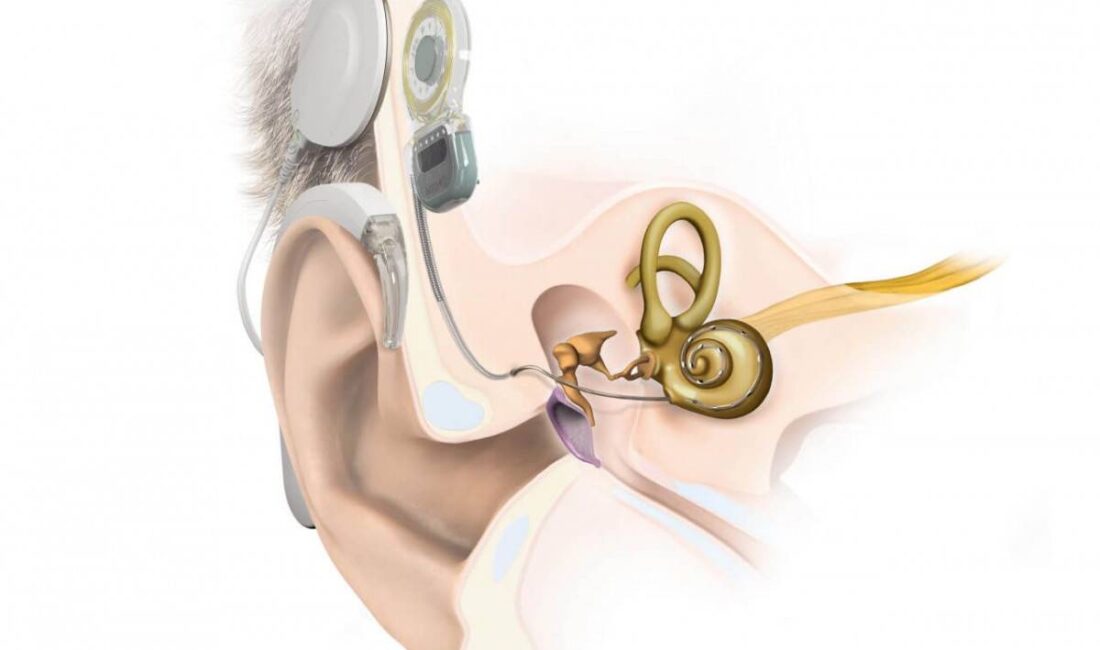 İKİ HASTAYA AMELİYAT GERÇEKLEŞTİRİLDİ Afyonkarahisar’da sadece Afyonkarahisar Sağlık Bilimleri Üniversitesi