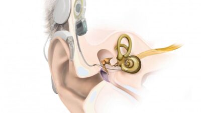 İKİ HASTAYA AMELİYAT GERÇEKLEŞTİRİLDİ Afyonkarahisar’da sadece Afyonkarahisar Sağlık Bilimleri Üniversitesi