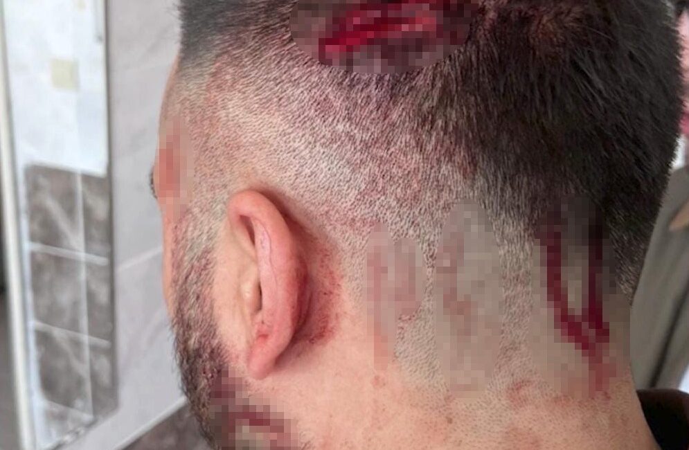 Şanlıurfa’nın Haliliye ilçesinde bulunan Uzunköy İlk ve Ortaokulunda görev yapan