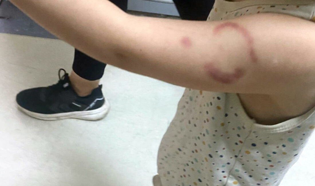 Edirne’de özel bir gündüz bakımevinde meydana gelen olayda, baba Y.K.,