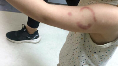 Edirne’de özel bir gündüz bakımevinde meydana gelen olayda, baba Y.K.,