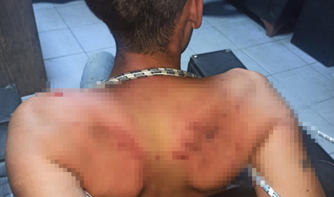 Antalya’da yaşanan tüyler ürperten olayda, 22 yaşındaki Vedat Kurt’un, çalıştığı