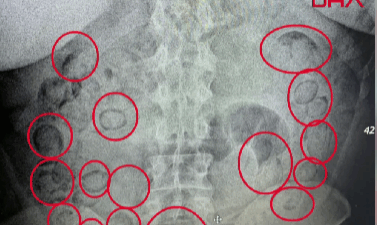 Aksaray Emniyet Müdürlüğü Narkotik Suçlarla Mücadele Şubesi ekipleri, Adana kara