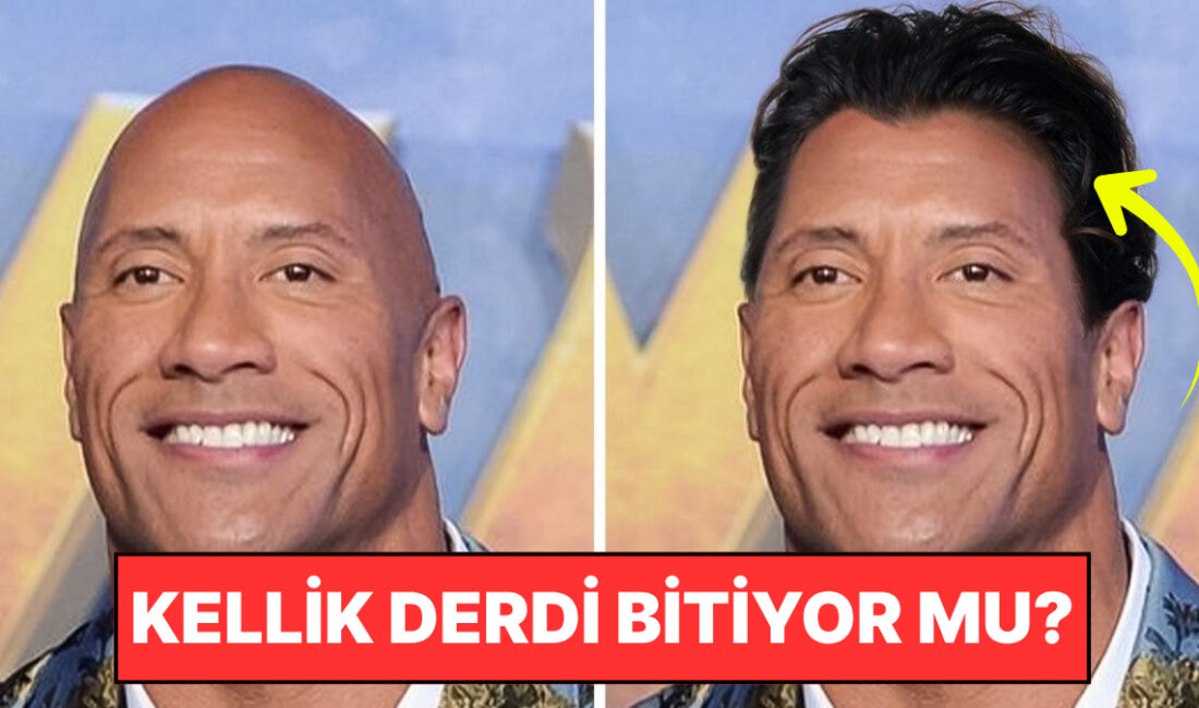 Kellik, genetik yatkınlık, yaşlanma, beslenme eksiklikleri ve stres gibi pek