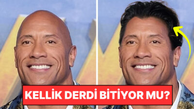 Kellik, genetik yatkınlık, yaşlanma, beslenme eksiklikleri ve stres gibi pek