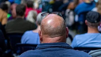 Ulusal Tayvan Üniversitesi sistem biyoloğu Kang-Yu Tai ve ekibi, deri