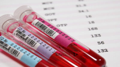 Brezilya’da 35 yaşındaki bir kadının hamilelik kaybı sonrası girdiği rutin