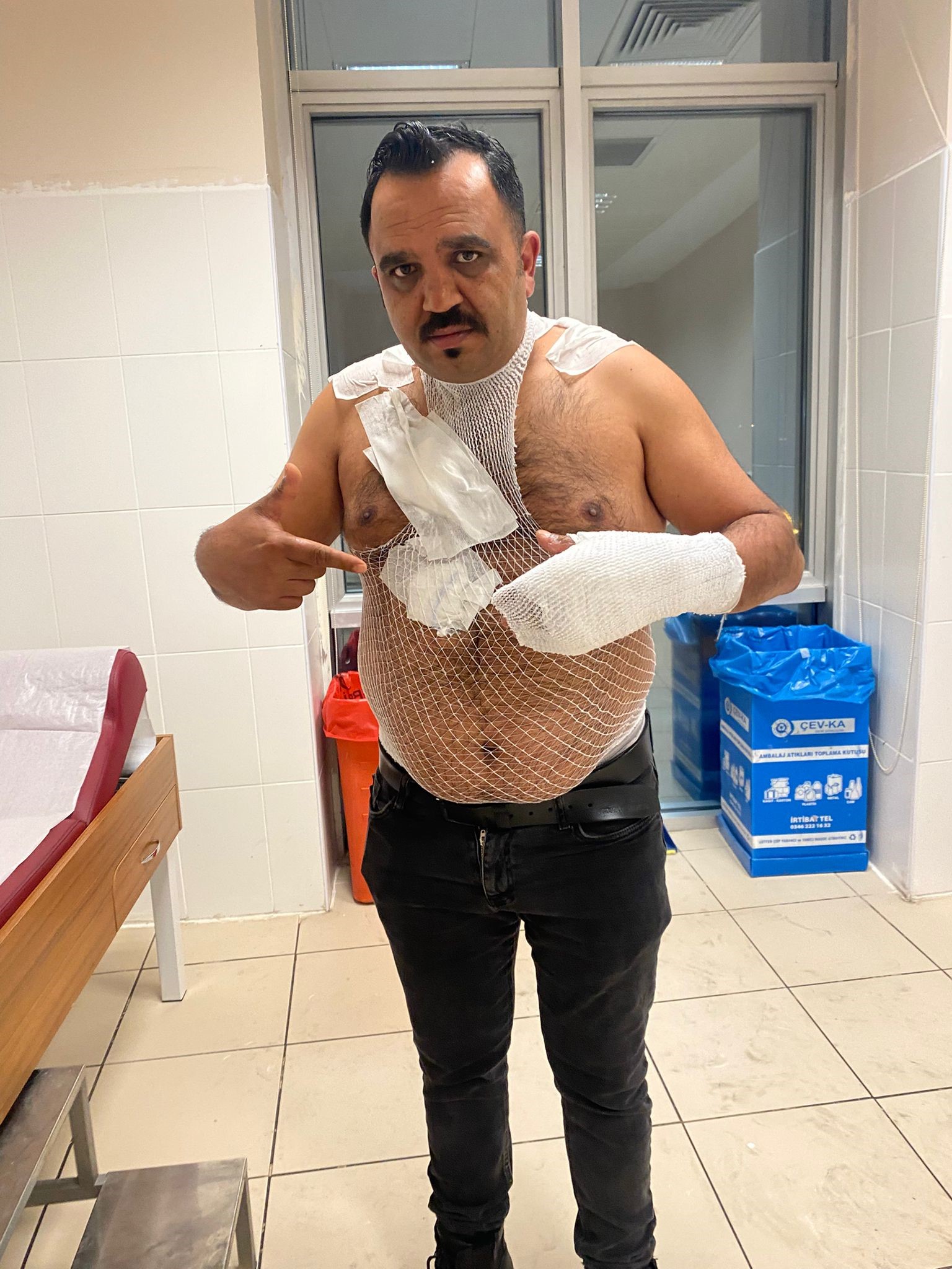 Fenomen tostçu cayır cayır yandı!