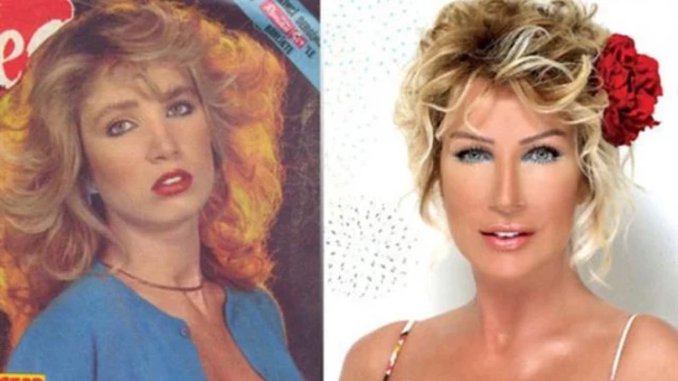 Cengiz Semercioğlu ile paylaştı Yaptırdığı estetik işlemleri hiçbir zaman saklamayan