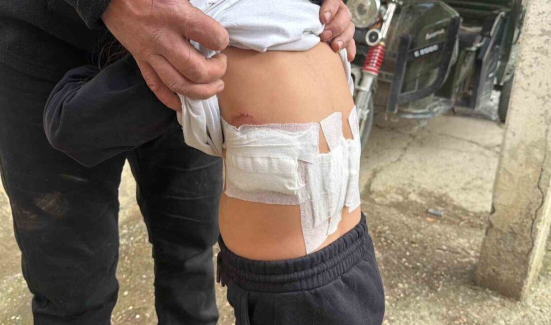 Afyonkarahisar’da evinin bahçesinde oynayan 5 yaşındaki kız çocuğu eşeğin saldırısı