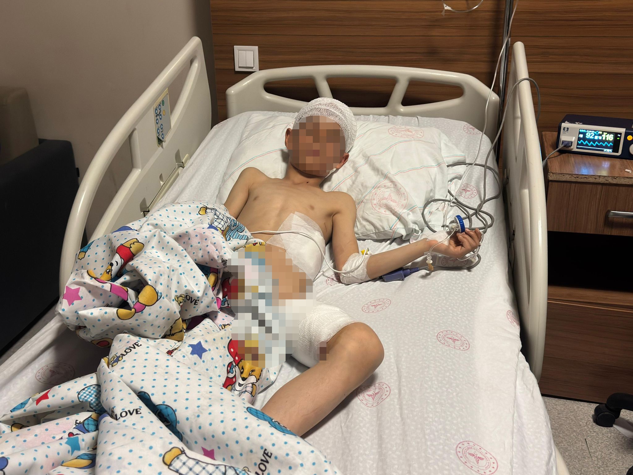 Bu çocuk bu hale nasıl geldi! 13 adet saldırdı…