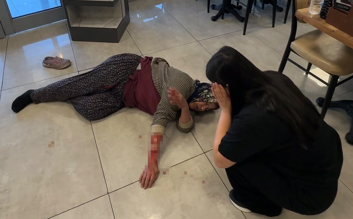 Dazkırı’da köpek saldırısında kadın ağır yaralandı