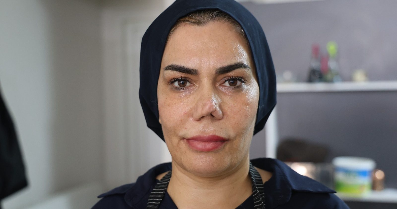 4 operasyon sonrası hayatı kabusa döndü