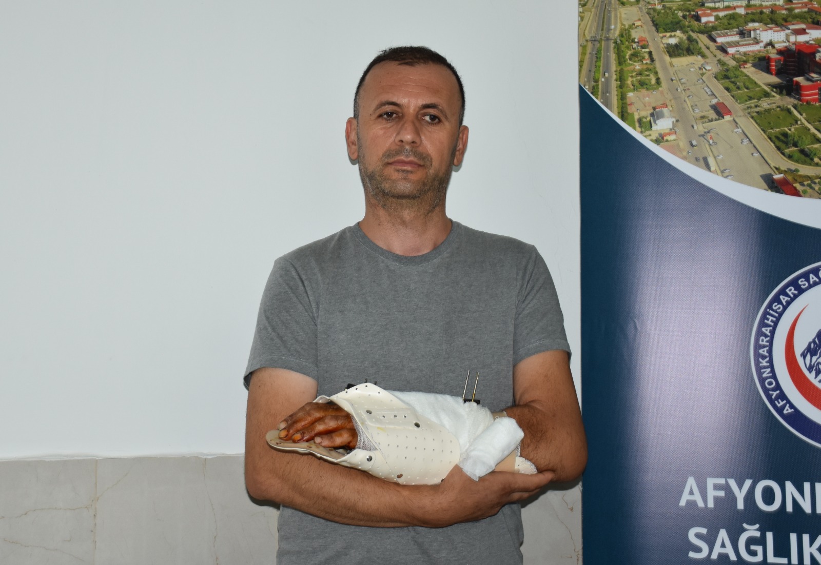 Bileği kopma noktasındaydı, 12 saatlik operasyonla kurtarıldı