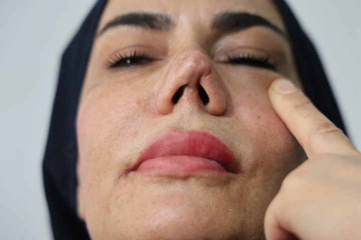 4 operasyon sonrası hayatı kabusa döndü